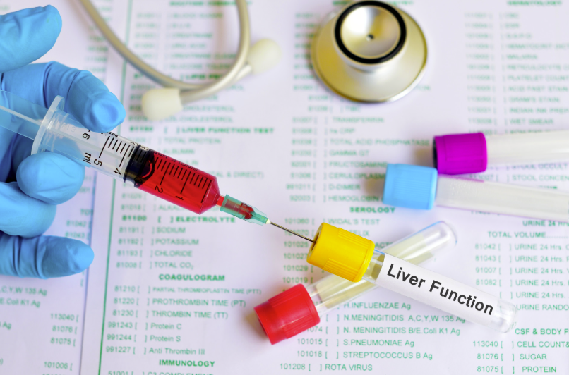 The silver nutritionist photo depicting a functional test to Uncover the root causes of health concerns with cutting-edge tests designed for a targeted, personalised approach to well-being. 